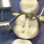 Dental Work