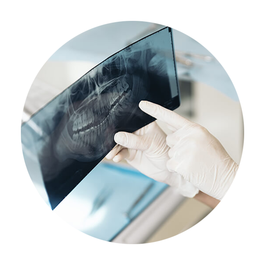 dental-x-ray_sidebanner