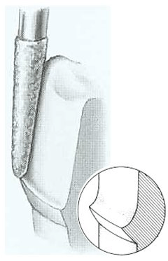 Image of chamfer