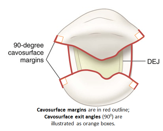 Image of cavosurface margins