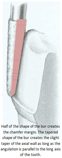 Image of chamfer bur