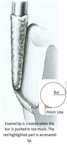 Image of enamel lip bur