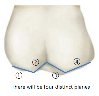 Image of a molar