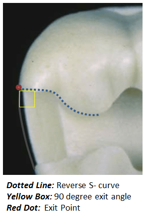 Image of making a proximal box