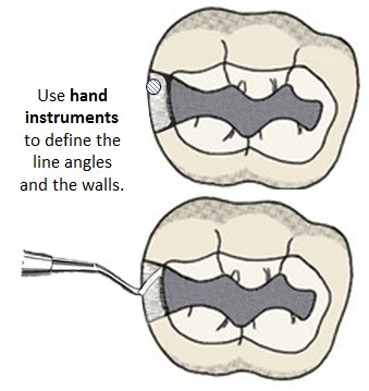 Image of Defined line angles