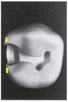 Image of enamel lips