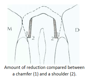 Image of chamfer shoulder